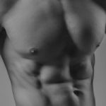 GYNECOMASTY