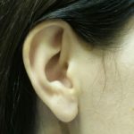 ear